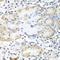 ARSA antibody, A06493, Boster Biological Technology, Immunohistochemistry paraffin image 