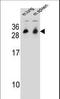 Cytochrome B561 Family Member D1 antibody, LS-C167189, Lifespan Biosciences, Western Blot image 