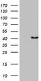 Pleckstrin 2 antibody, TA802769AM, Origene, Western Blot image 