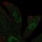 Kinesin Family Member 12 antibody, NBP1-86029, Novus Biologicals, Immunofluorescence image 