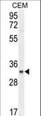 Chromosome 11 Open Reading Frame 74 antibody, LS-C156945, Lifespan Biosciences, Western Blot image 