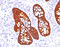Keratin-19 antibody, AM50256PU-T, Origene, Immunohistochemistry paraffin image 