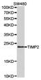 Metalloproteinase inhibitor 2 antibody, TA327073, Origene, Western Blot image 