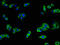 Melanotransferrin antibody, A62954-100, Epigentek, Immunofluorescence image 