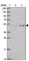 Elongation factor 1-gamma antibody, NBP1-91862, Novus Biologicals, Western Blot image 