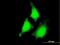 Mitogen-Activated Protein Kinase Kinase 5 antibody, H00005607-M03, Novus Biologicals, Immunocytochemistry image 
