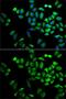 Angiopoietin-related protein 4 antibody, GTX30047, GeneTex, Immunofluorescence image 