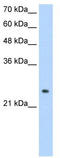 Alcohol Dehydrogenase 6 (Class V) antibody, TA346214, Origene, Western Blot image 