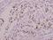 Sp1 Transcription Factor antibody, A00110T453, Boster Biological Technology, Immunohistochemistry paraffin image 