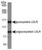 Low Density Lipoprotein Receptor antibody, PA5-22976, Invitrogen Antibodies, Western Blot image 
