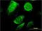 BCAP29, CT antibody, H00055973-M07, Novus Biologicals, Immunofluorescence image 