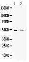 Cholinergic Receptor Nicotinic Alpha 5 Subunit antibody, PA5-79046, Invitrogen Antibodies, Western Blot image 