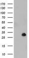 N-Ribosyldihydronicotinamide:Quinone Reductase 2 antibody, TA504753S, Origene, Western Blot image 