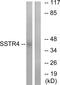 Somatostatin receptor type 4 antibody, A05232, Boster Biological Technology, Western Blot image 