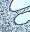 Epidermal growth factor receptor substrate 15-like 1 antibody, orb78307, Biorbyt, Immunohistochemistry paraffin image 