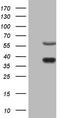 Nuclear Receptor Subfamily 1 Group D Member 2 antibody, TA806369, Origene, Western Blot image 