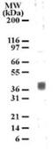 5-Hydroxytryptamine Receptor 1B antibody, GTX13896, GeneTex, Western Blot image 