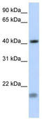 Short stature homeobox protein 2 antibody, TA333910, Origene, Western Blot image 