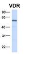 Potassium Voltage-Gated Channel Subfamily A Member 10 antibody, orb184609, Biorbyt, Western Blot image 