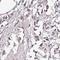 CDKN1A Interacting Zinc Finger Protein 1 antibody, HPA020387, Atlas Antibodies, Immunohistochemistry paraffin image 