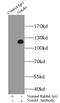 NICD antibody, FNab05799, FineTest, Immunoprecipitation image 