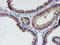 Leukocyte Cell Derived Chemotaxin 2 antibody, TA504091, Origene, Immunohistochemistry paraffin image 