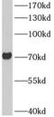 Acid Sensing Ion Channel Subunit 2 antibody, FNab00638, FineTest, Western Blot image 