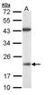 Dual Specificity Phosphatase 3 antibody, orb73904, Biorbyt, Western Blot image 