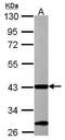 Acetyl-CoA Acyltransferase 1 antibody, GTX114229, GeneTex, Western Blot image 