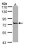 Bardet-Biedl Syndrome 10 antibody, TA308059, Origene, Western Blot image 