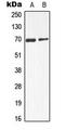 Alpha Fetoprotein antibody, LS-C353913, Lifespan Biosciences, Western Blot image 