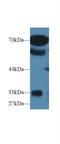 Protein OS-9 antibody, LS-C687371, Lifespan Biosciences, Western Blot image 