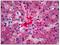 Human Fibrinogen antibody, AP31151PU-N, Origene, Immunohistochemistry frozen image 
