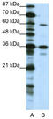 Cyclic AMP-responsive element-binding protein 3-like protein 1 antibody, TA345484, Origene, Western Blot image 