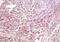 MHC Class I Polypeptide-Related Sequence A antibody, orb11047, Biorbyt, Immunohistochemistry paraffin image 