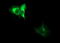 ADAM Metallopeptidase With Thrombospondin Type 1 Motif 8 antibody, LS-C174472, Lifespan Biosciences, Immunofluorescence image 