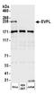 p210 antibody, A305-582A-M, Bethyl Labs, Western Blot image 