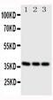 CD1a Molecule antibody, PA5-78962, Invitrogen Antibodies, Western Blot image 