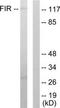 FERM, ARH/RhoGEF And Pleckstrin Domain Protein 2 antibody, TA314975, Origene, Western Blot image 