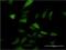DnaJ Heat Shock Protein Family (Hsp40) Member C3 antibody, H00005611-M03, Novus Biologicals, Immunocytochemistry image 