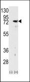 Protein kinase C delta type antibody, TA324893, Origene, Western Blot image 