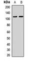 HIRA antibody, LS-C667839, Lifespan Biosciences, Western Blot image 