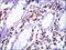 Moesin antibody, GTX60569, GeneTex, Immunohistochemistry paraffin image 