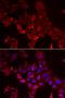NADH dehydrogenase [ubiquinone] iron-sulfur protein 4, mitochondrial antibody, orb247407, Biorbyt, Immunofluorescence image 