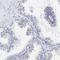 Dual Specificity Phosphatase 9 antibody, HPA003336, Atlas Antibodies, Immunohistochemistry paraffin image 