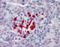 Von Hippel-Lindau Tumor Suppressor antibody, 48-047, ProSci, Immunohistochemistry paraffin image 