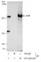 ATR Serine/Threonine Kinase antibody, GTX128146, GeneTex, Immunoprecipitation image 