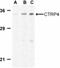 C1q And TNF Related 4 antibody, NBP1-76630, Novus Biologicals, Western Blot image 