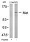 MET antibody, 79-587, ProSci, Western Blot image 