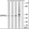 G Protein-Coupled Receptor 52 antibody, orb94238, Biorbyt, Western Blot image 